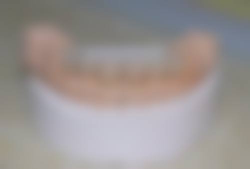 上海交通大学医学校附属第九人民医院（南部院区）陈骏医生擅长项目