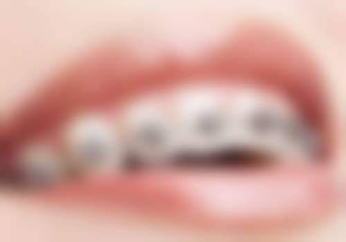 深圳市希华爱康健医院口腔科医院特色项目