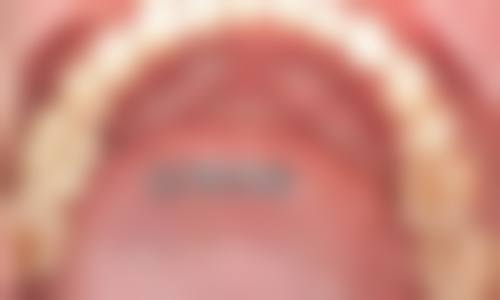 河北省保定市第二医院庞杰医生擅长项目