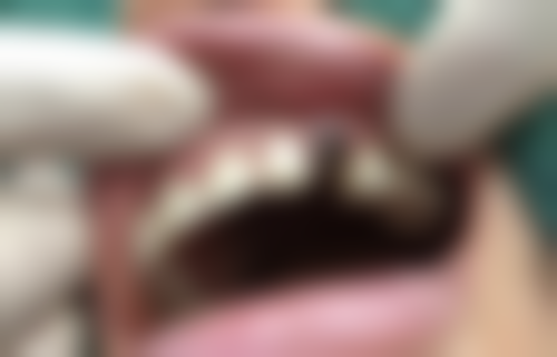 台州市牙博士口腔门诊刘丹旭医生的收费价格表