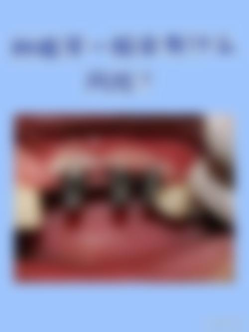 昆明尚爱韩美口腔周铭医生技术特色