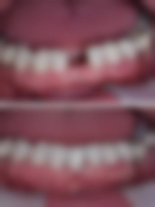 首都医 科 大学附属北京世纪坛医院周铭医生技术特色