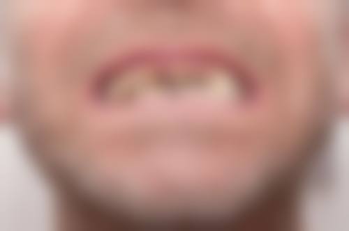 绵阳市中 心医院郭秀全医生技术特色