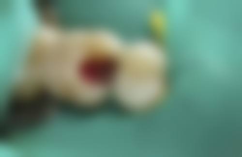 广州视献眼科门诊部李娇娇医生简介