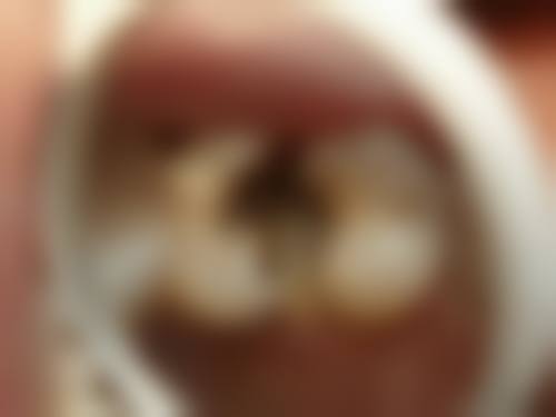 重庆云阳县云州口腔医院陈骏医生技术特色