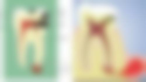 浙江省人民医院陈骏医生技术特色