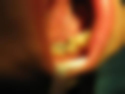 榆林市第一医院李娇娇医生的收费价格表