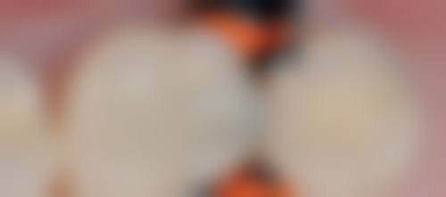 垣曲县人民医院李娇娇医生技术特色