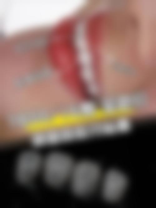 大连医 科 大学附属第二医院陈骏医生擅长项目