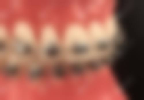 乐昌佗城综合门诊部钟秀珍医生口碑评价