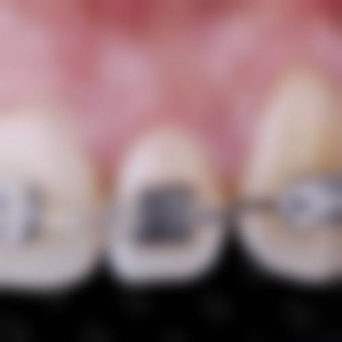 乐昌佗城综合门诊部钟秀珍医生的收费价格表