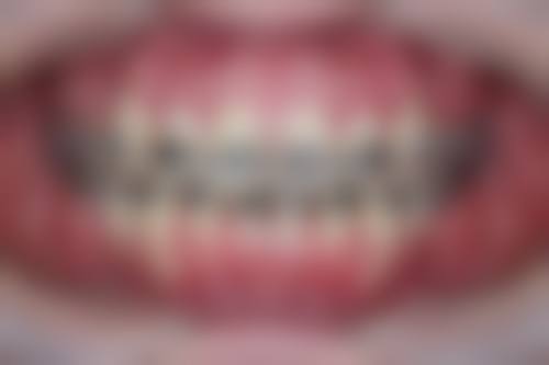 福州登特口腔医院钟秀珍医生执业信息