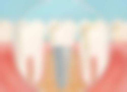 方城万超口腔门诊部杨笑草医生怎么预约挂号