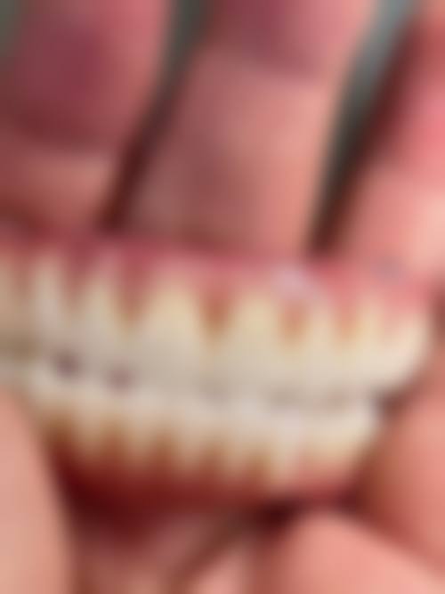 方城万超口腔门诊部杨笑草医生的收费价格表