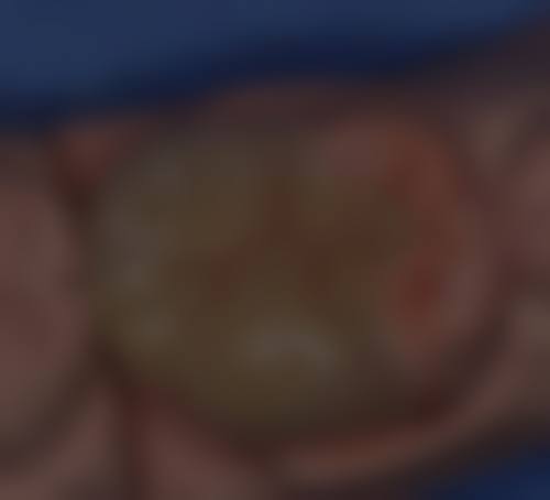 中日友好医院高一医生擅长项目