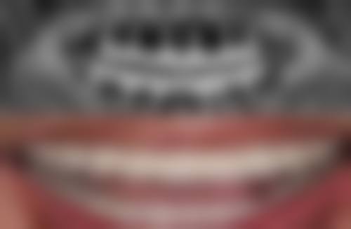 广州拜博口腔（博尔店）医院特色项目