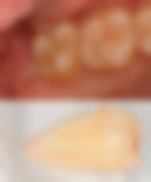 中日友好医院张晔医生怎么预约挂号