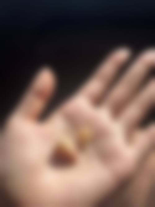 中日友好医院张晔医生技术特色