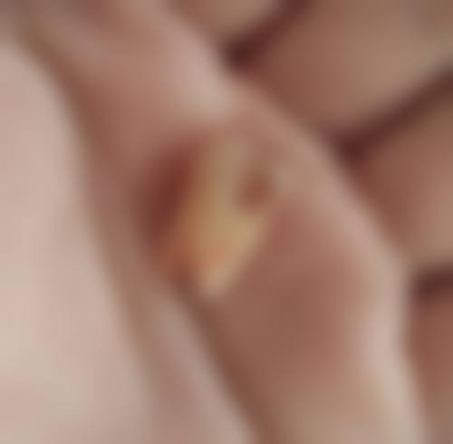 天津市第三中 心医院张晔医生口碑评价