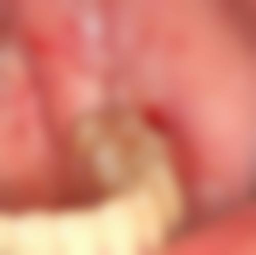 中日友好医院张晔医生执业信息