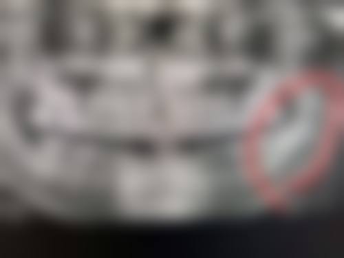 中日友好医院张晔医生的收费价格表