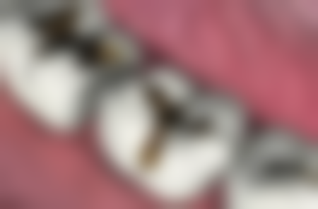 濮阳柏林口腔医疗医院医院项目价格