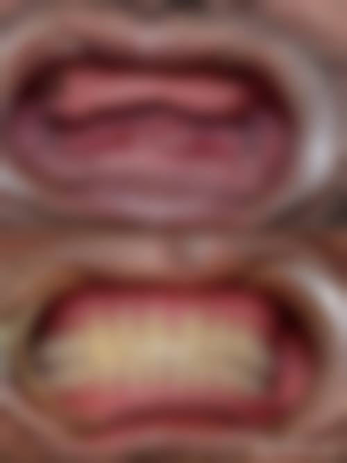 河北大学附属医院李大海医生的收费价格表