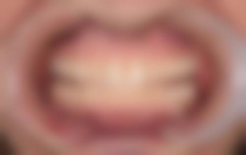 承德医学校附属医院李大海医生口碑评价