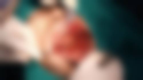 广西医 科 大学第一附属医院李大海医生口碑评价