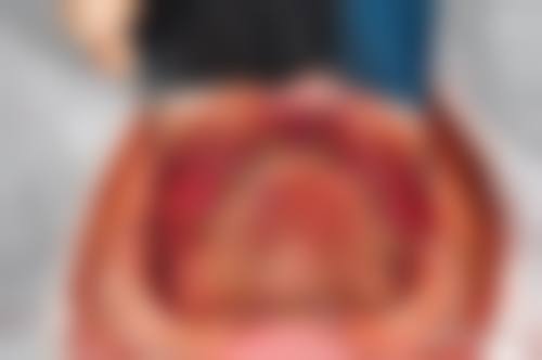 河北大学附属医院李大海医生口碑评价