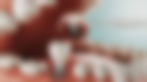 福建医 科 大学附属协和医院陈文华医生怎么预约挂号