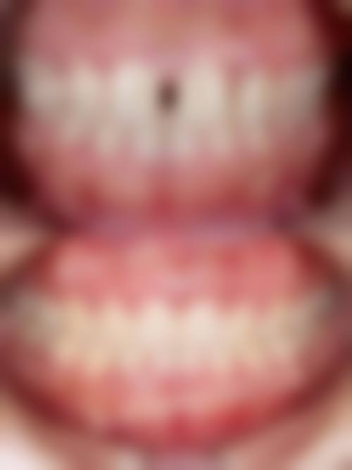 新泰市第二人民医院魏婷医生擅长项目