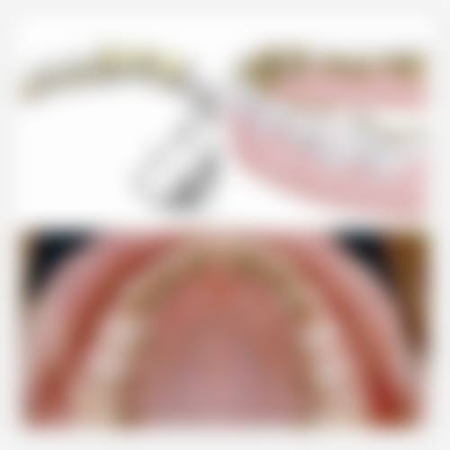 佛山广大口腔门诊部（禅城院）魏婷医生口碑评价