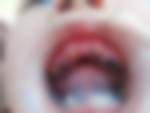 山东第一医 科 大学附属肿 瘤医院李金鹏医生怎么预约挂号