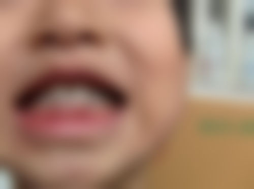 南昌大学附属口腔医院李金鹏医生技术特色