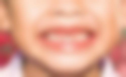 滨州市第二人民医院李金鹏医生技术特色