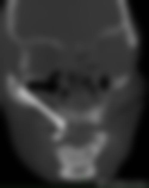 上海华尔康口腔松江总院王帅医生技术特色