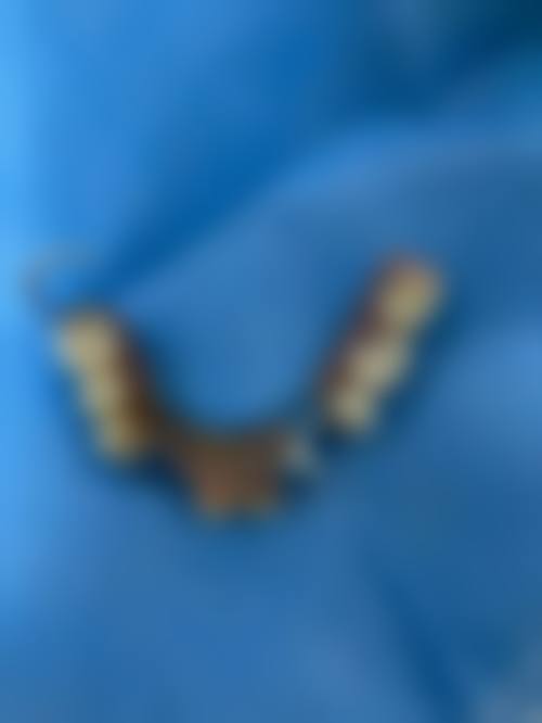 威海美辰口腔医院富宏伟医生的收费价格表