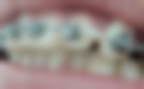 武汉大众口腔(光谷店)医院电话