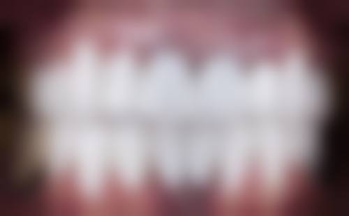 威海美辰口腔医院富宏伟医生技术特色