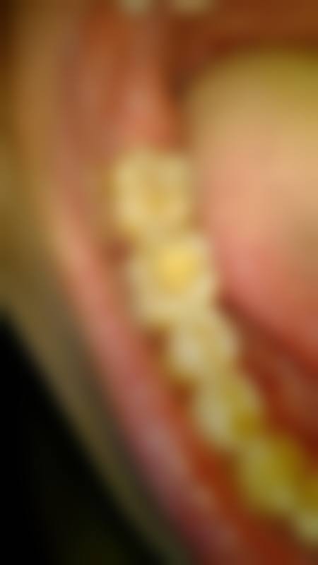 四川大学华 西第二医院胡倩医生技术特色