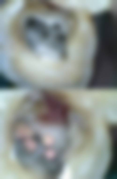 梁山县馆驿卫生院胡倩医生怎么预约挂号