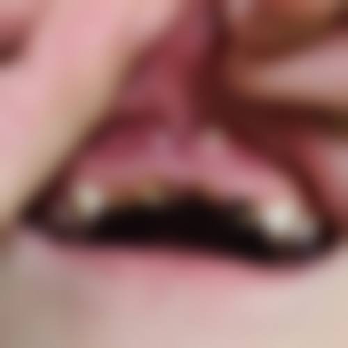 贵阳市第一人民医院冯进医生技术特色