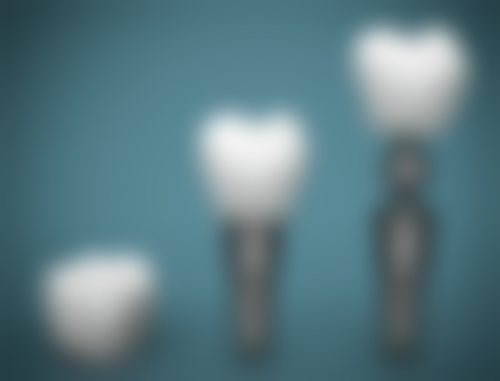 湘潭安信口腔诊所医院特色项目