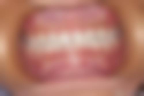 河源华信泰康医院任伟伟医生技术特色