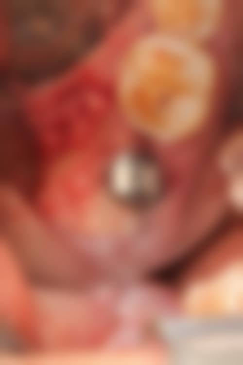 丹阳现代口腔门诊部封岩医生口碑评价