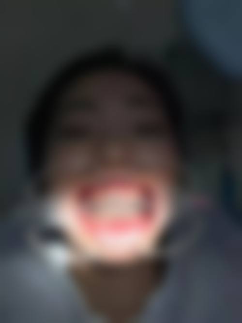 小白兔口腔医疗科技集团西安雁塔兔博士朱雀口腔门诊部冯小茜医生的收费价格表