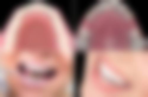 大连市甘井子区妇幼保健院及邓州兴业口腔门诊部张草医生的收费价格表