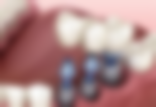 潍坊口腔医院刘军华医生的收费价格表