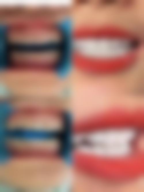 中日友好医院乔敏医生技术特色